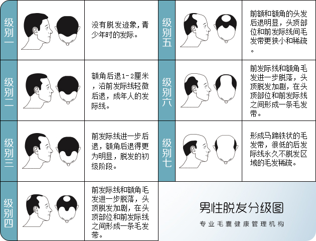 男性脱发等级对照图